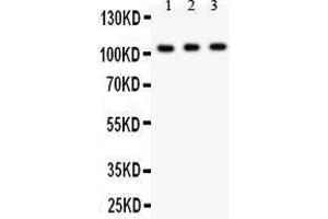 Anti- GRIK1 antibody, Western blotting All lanes: Anti GRIK1  at 0.