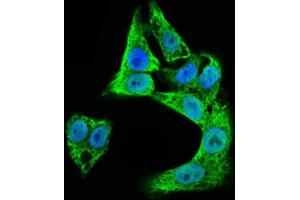 Immunofluorescence analysis of HepG2 cells using DCX antibody (green). (Doublecortin antibody  (AA 362-411))