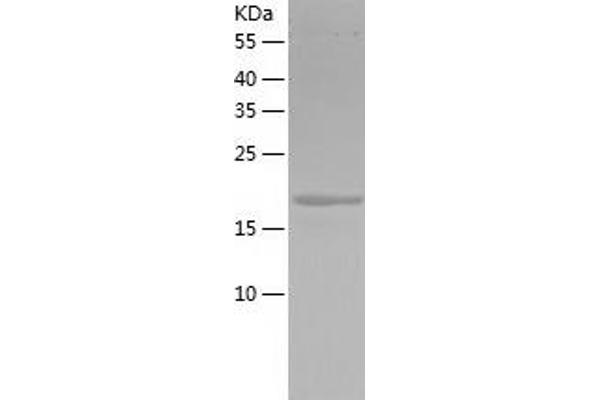 MYL9 Protein (AA 1-172) (His tag)
