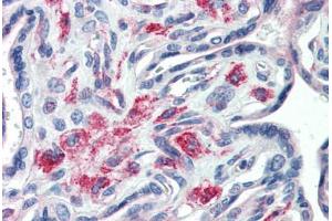 anti-Syntaxin 12 (STX12) (Cytoplasmic Domain) antibody