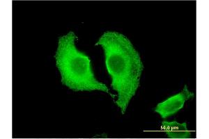 Immunofluorescence of monoclonal antibody to CTRB1 on HeLa cell. (CTRB1 antibody  (AA 101-200))