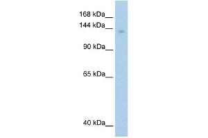 WB Suggested Anti-MOV10 Antibody Titration:  1. (MOV10 antibody  (C-Term))