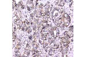 IHC analysis of RAB27A using anti-RAB27A antibody . (RAB27A antibody  (AA 98-216))