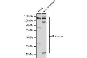 Western blot analysis of extracts of various cell lines, using Ubiquitin pAb  at 1:3000 dilution. (Ubiquitin B antibody)