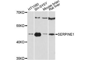 Western blot analysis of extracts of various cell lines, using SERPINE1 antibody (ABIN5998780) at 1:3000 dilution. (PAI1 antibody)