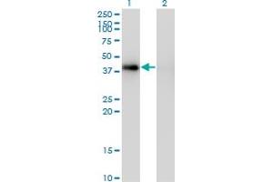 Western Blot analysis of PCYT1A expression in transfected 293T cell line by PCYT1A monoclonal antibody (M03), clone 7H8. (PCYT1A antibody  (AA 2-90))
