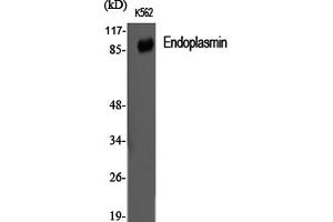 Western Blotting (WB) image for anti-Heat Shock Protein 90kDa beta (Grp94), Member 1 (HSP90B1) antibody (ABIN5959523) (GRP94 antibody)