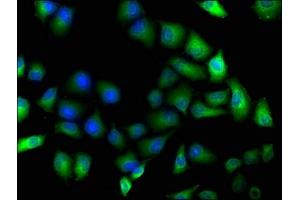 Immunofluorescence staining of Hela cells with ABIN7163757 at 1:100, counter-stained with DAPI. (PARP8 antibody  (AA 628-854))