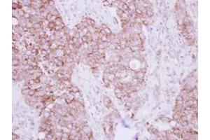 Image no. 1 for anti-Transforming Growth Factor beta Regulator 4 (TBRG4) (AA 1-328) antibody (ABIN1501337) (TBRG4 antibody  (AA 1-328))