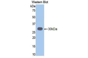 Detection of Recombinant ELA3B, Mouse using Polyclonal Antibody to Elastase 3B (ELA3B) (Elastase 3B antibody  (AA 28-267))