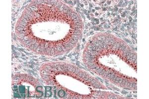 ABIN571095 (3. (Sorting Nexin 1 antibody  (Internal Region))