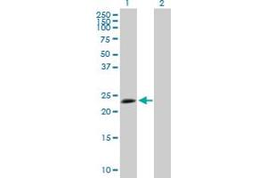 Western Blot analysis of TPD52L1 expression in transfected 293T cell line by TPD52L1 MaxPab polyclonal antibody.