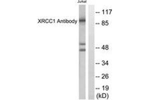 Western blot analysis of extracts from Jurkat cells, using XRCC1 Antibody. (RCC1 antibody  (AA 517-566))