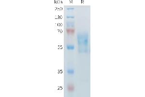 Mouse PD-1 Protein, hFc Tag on SDS-PAGE under reducing condition.