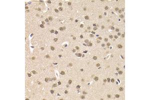 Immunohistochemistry of paraffin-embedded mouse brain using CSNK1E Antibody. (CK1 epsilon antibody)