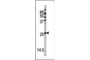 The anti-Phospho-p27Kip1- Pab (ABIN389615 and ABIN2839619) is used in Western blot to detect Phospho-p27Kip1- in HL60 tissue lysate (CDKN1B antibody  (pSer178))