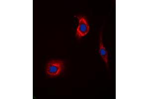 Immunofluorescent analysis of GAK staining in Hela cells. (GAK antibody  (N-Term))