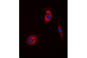 Immunofluorescent analysis of GAK staining in Hela cells.