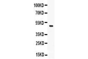 Western blot analysis of ADFP expression in MCF-7 whole cell lysates ( Lane 1). (ADRP antibody  (AA 226-418))