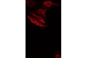 ABIN6276512 staining  HeLa cells by IF/ICC. (SMAD1 antibody  (Internal Region))