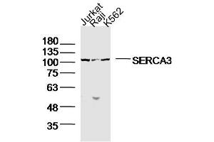 Lane1: jurkat Lane 2: raji Lane 3: K562 lysates probed with SERCA3 Polyclonal Antibody, Unconjugated  at 1:300 dilution and 4˚C overnight incubation. (ATP2A3 antibody  (AA 101-200))