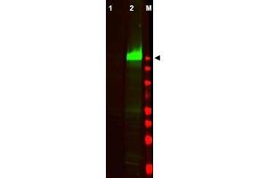 Image no. 2 for anti-Epidermal Growth Factor Receptor (EGFR) (AA 1189-1199), (pTyr1197) antibody (ABIN401341) (EGFR antibody  (pTyr1197))