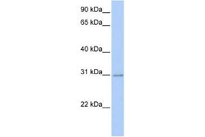 WB Suggested Anti-HOXC11 Antibody Titration:  0. (HOXC11 antibody  (Middle Region))