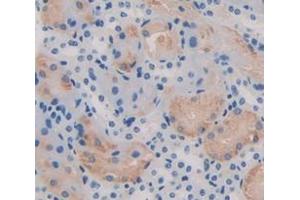 Figure. (Transportin 1 antibody  (AA 597-837))