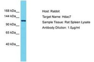 Image no. 1 for anti-Histone Deacetylase 7 (HDAC7) (AA 57-106) antibody (ABIN6750273) (HDAC7 antibody  (AA 57-106))