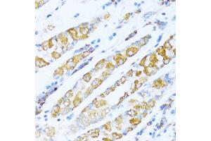 Immunohistochemistry (IHC) image for anti-NADH Dehydrogenase (Ubiquinone) 1 alpha Subcomplex, 5, 13kDa (NDUFA5) (AA 1-116) antibody (ABIN7268804)