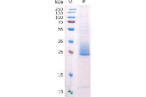 SDS-PAGE (SDS) image for Angiopoietin-Like 3 (ANGPTL3) (AA 17-221) protein (His tag) (ABIN6964117)
