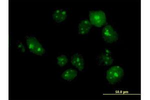 Immunofluorescence of purified MaxPab antibody to TTLL6 on HeLa cell. (TTLL6 antibody  (AA 1-569))