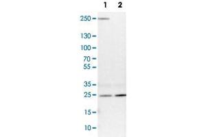 Western Blot analysis of Lane 1: NIH-3T3 cell lysate (mouse embryonic fibroblast cells) and Lane 2: NBT-II cell lysate (Wistar rat bladder tumour cells) with VPS28 polyclonal antibody .