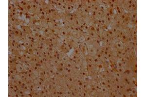 Immunohistochemistry (IHC) image for anti-Nuclear Factor of kappa Light Polypeptide Gene Enhancer in B-Cells Inhibitor, alpha (NFKBIA) (AA 27-317) antibody (ABIN7161520)