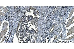 IHC analysis of MCU using anti-MCU antibody (ABIN7601931). (MCU antibody  (AA 51-351))