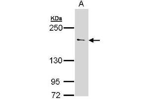 WB Image Sample (30 ug of whole cell lysate) A: 293T 5% SDS PAGE antibody diluted at 1:500 (UNC13B antibody  (Internal Region))