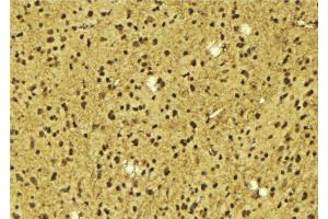 ABIN6275631 at 1/100 staining Mouse brain tissue by IHC-P. (TIGD3 antibody  (Internal Region))