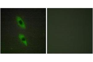 Immunofluorescence analysis of HuvEc cells, using FADD Antibody.