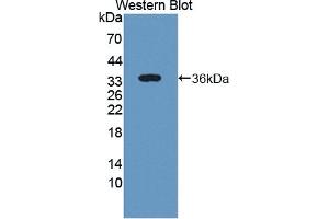 Detection of Recombinant ST2, Human using Polyclonal Antibody to Syntenin 2 (ST2) (SDCBP2 antibody  (AA 1-292))