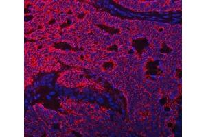 IF analysis of TFEB using anti-TFEB antibody (ABIN7600648). (TFEB antibody  (AA 214-326))