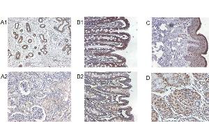Immunohistochemical staining of IL-37 in human kidney (A1), human colon (B1), human skin (C) and human stomach (D) using anti-IL-37 . (IL-37 antibody)