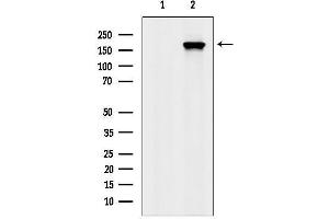 Western blot analysis of lysates from H2O2 treated EC304 cells, using Phospho-EGFR (Thr678) Antibody.