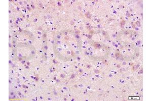 Formalin-fixed and paraffin embedded mouse brain tissue labeled with Anti-RAP1A Polyclonal Antibody, Unconjugated (ABIN687472) at 1:200 followed by conjugation to the secondary antibody, (SP-0023), and DAB staining (RAP1A antibody  (AA 101-184))