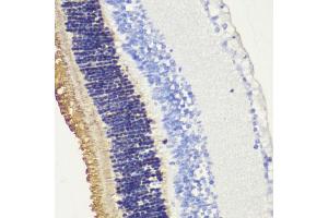 Immunohistochemistry of paraffin-embedded mouse retina using Rhodopsindopsin antibody (ABIN7269975) at dilution of 1:200 (40x lens). (Rho-related GTP-binding protein antibody  (C-Term))