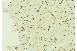 ABIN6276435 at 1/100 staining Mouse brain tissue by IHC-P.