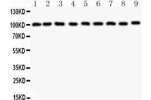 Western Blotting (WB) image for anti-Cas-Br-M (Murine) Ecotropic Retroviral Transforming Sequence (CBL) (AA 556-906) antibody (ABIN3043746) (CBL antibody  (AA 556-906))