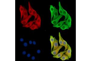 ABIN7097156 and ABIN7101224 staining Hela cells by IF/ICC. (CPQ antibody)