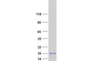 Validation with Western Blot (SPACA4 Protein (Myc-DYKDDDDK Tag))