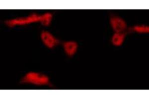 ABIN6267489 staining HepG2 by IF/ICC. (Aryl Hydrocarbon Receptor antibody  (pSer36))