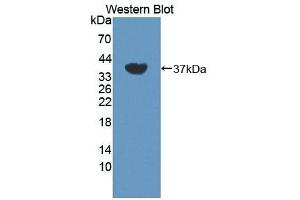 Detection of Recombinant DYRK1A, Human using Polyclonal Antibody to Dual Specificity Tyrosine Phosphorylation Regulated Kinase 1A (DYRK1A) (DYRK1A antibody  (AA 16-300))